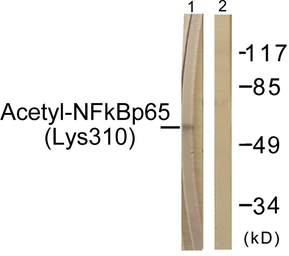 Anti-NFkB p65 (acetyl Lys310) antibody used in Western Blot (WB). GTX86963