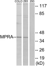 Anti-MPRA antibody used in Western Blot (WB). GTX86972