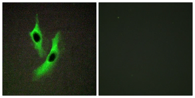 Anti-STEAP4 antibody used in Immunocytochemistry/ Immunofluorescence (ICC/IF). GTX86977
