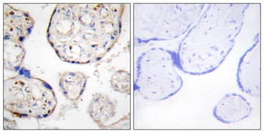 Anti-STEAP4 antibody used in IHC (Paraffin sections) (IHC-P). GTX86977