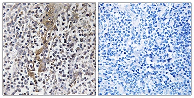 Anti-TMC8 antibody used in IHC (Paraffin sections) (IHC-P). GTX86980