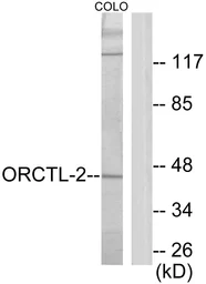 Anti-ORCTL2 antibody used in Western Blot (WB). GTX86982
