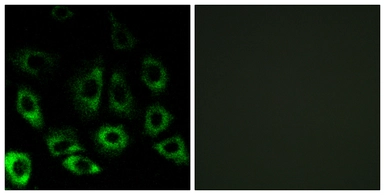 Anti-MBTPS2 antibody used in Immunocytochemistry/ Immunofluorescence (ICC/IF). GTX86983
