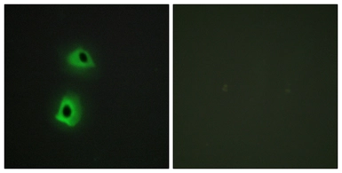 Anti-T3JAM antibody used in Immunocytochemistry/ Immunofluorescence (ICC/IF). GTX86987