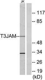 Anti-T3JAM antibody used in Western Blot (WB). GTX86987