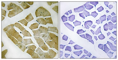 Anti-MYH4 antibody used in IHC (Paraffin sections) (IHC-P). GTX86988