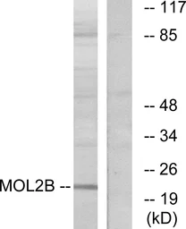 Anti-MOBKL2B antibody used in Western Blot (WB). GTX86990