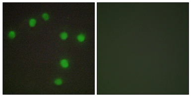 Anti-NKX6.3 antibody used in Immunocytochemistry/ Immunofluorescence (ICC/IF). GTX86996