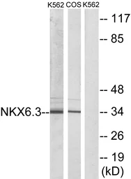 Anti-NKX6.3 antibody used in Western Blot (WB). GTX86996