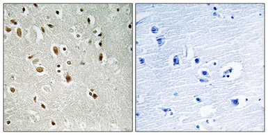 Anti-ANKRD20A3 antibody used in IHC (Paraffin sections) (IHC-P). GTX86997