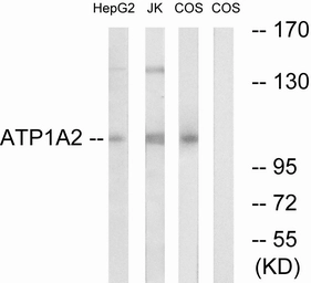 Anti-Sodium Potassium ATPase alpha 2 antibody used in Western Blot (WB). GTX87004