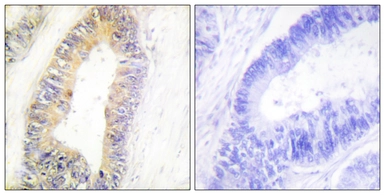 Anti-ZNF638 antibody used in IHC (Paraffin sections) (IHC-P). GTX87005