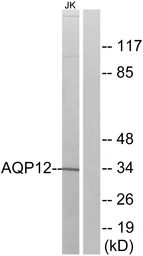 Anti-Aquaporin 12 antibody used in Western Blot (WB). GTX87006