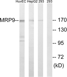 Anti-ABCC12 antibody used in Western Blot (WB). GTX87007