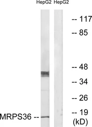 Anti-MRPS36 antibody used in Western Blot (WB). GTX87009