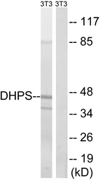 Anti-DHPS antibody used in Western Blot (WB). GTX87013