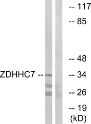 Anti-ZDHHC7 antibody used in Western Blot (WB). GTX87016