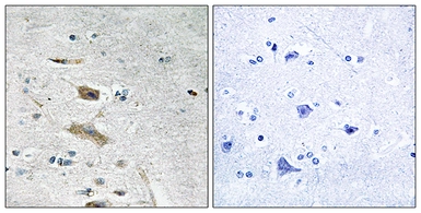 Anti-ABHD4 antibody used in IHC (Paraffin sections) (IHC-P). GTX87018