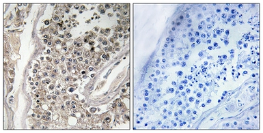 Anti-RAB3GAP1 antibody used in IHC (Paraffin sections) (IHC-P). GTX87019