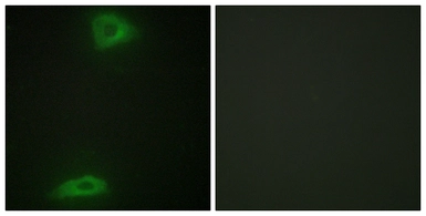 Anti-ERGIC3 antibody used in Immunocytochemistry/ Immunofluorescence (ICC/IF). GTX87022