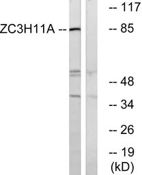 Anti-ZC3H11A antibody used in Western Blot (WB). GTX87024