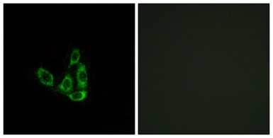 Anti-GCNT3 antibody used in Immunocytochemistry/ Immunofluorescence (ICC/IF). GTX87025