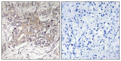 Anti-GCNT3 antibody used in IHC (Paraffin sections) (IHC-P). GTX87025