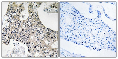 Anti-GPSN2 antibody used in IHC (Paraffin sections) (IHC-P). GTX87026