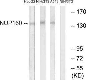 Anti-NUP160 antibody used in Western Blot (WB). GTX87027