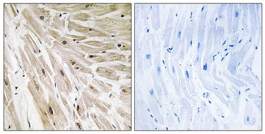 Anti-RPL22 antibody used in IHC (Paraffin sections) (IHC-P). GTX87028