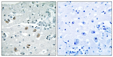 Anti-PLA2G4D antibody used in IHC (Paraffin sections) (IHC-P). GTX87029