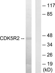 Anti-p39 antibody used in Western Blot (WB). GTX87033