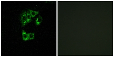 Anti-GIMAP2 antibody used in Immunocytochemistry/ Immunofluorescence (ICC/IF). GTX87040