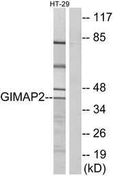 Anti-GIMAP2 antibody used in Western Blot (WB). GTX87040