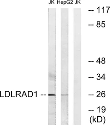 Anti-LDLRAD1 antibody used in Western Blot (WB). GTX87041