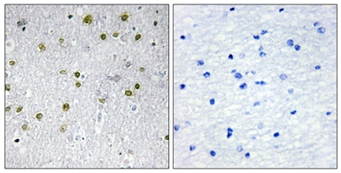 Anti-NRIP2 antibody used in IHC (Paraffin sections) (IHC-P). GTX87043