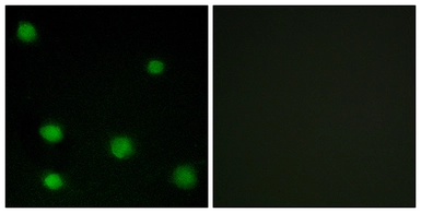 Anti-RBM6 antibody used in Immunocytochemistry/ Immunofluorescence (ICC/IF). GTX87044