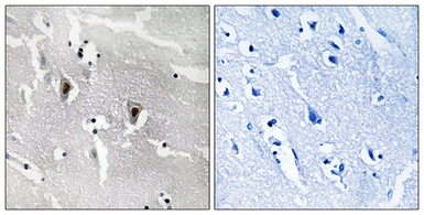 Anti-RBM6 antibody used in IHC (Paraffin sections) (IHC-P). GTX87044