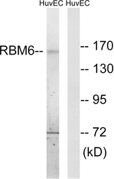 Anti-RBM6 antibody used in Western Blot (WB). GTX87044