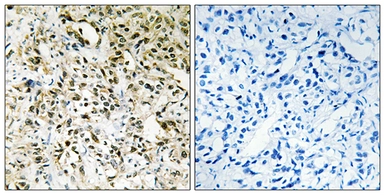 Anti-PPHLN antibody used in IHC (Paraffin sections) (IHC-P). GTX87045