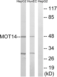 Anti-MCT14 antibody used in Western Blot (WB). GTX87051