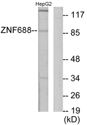 Anti-ZNF688 antibody used in Western Blot (WB). GTX87053
