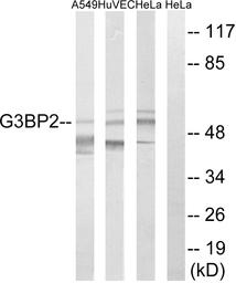Anti-G3BP2 antibody used in Western Blot (WB). GTX87055