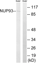 Anti-NUP93 antibody used in Western Blot (WB). GTX87060