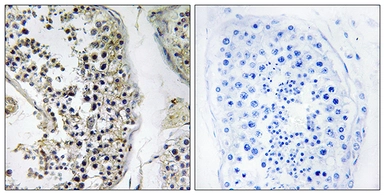 Anti-CEP170 antibody used in IHC (Paraffin sections) (IHC-P). GTX87061