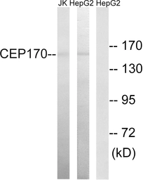 Anti-CEP170 antibody used in Western Blot (WB). GTX87061
