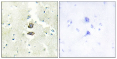 Anti-BRI3B antibody used in IHC (Paraffin sections) (IHC-P). GTX87070