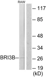Anti-BRI3B antibody used in Western Blot (WB). GTX87070