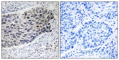 Anti-Pyruvate Carboxylase antibody used in IHC (Paraffin sections) (IHC-P). GTX87071