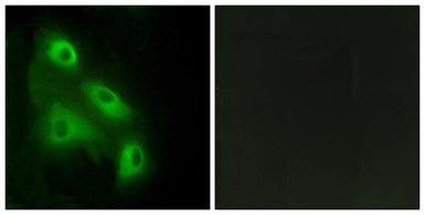 Anti-EPS8L3 antibody used in Immunocytochemistry/ Immunofluorescence (ICC/IF). GTX87073
